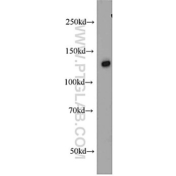 SREBF1 Rabbit Polyclonal Antibody (14088-1-AP)