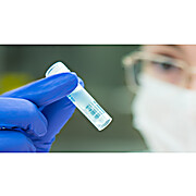 PROtrol SARS-CoV-2