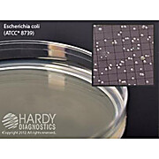 R2A Agar