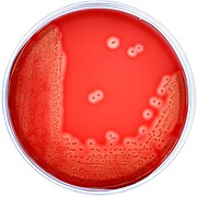 GBS Detect, for non-hemolytic Group B Strep, Reduced Stacking Ring (RSR)