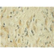 URG4 Rabbit Polyclonal Antibody (11998-1-AP)