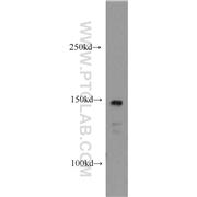 CSPP1 Rabbit Polyclonal Antibody (11931-1-AP)