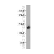 STMN4 Rabbit Polyclonal Antibody (12027-1-AP)