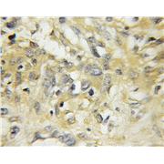 RAB5A Rabbit Polyclonal Antibody (11947-1-AP)