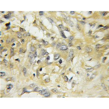 RAB5A Rabbit Polyclonal Antibody (11947-1-AP)