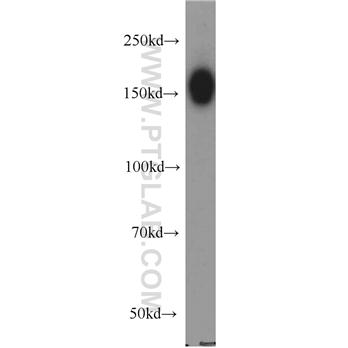 DISP1 Rabbit Polyclonal Antibody (12041-1-AP)