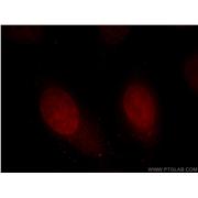 HMG20A Rabbit Polyclonal Antibody (12085-2-AP)