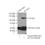 SLC4A4 Rabbit Polyclonal Antibody (11885-1-AP)