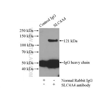 SLC4A4 Rabbit Polyclonal Antibody (11885-1-AP)