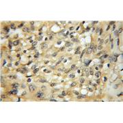 VPS45 Rabbit Polyclonal Antibody (12006-1-AP)