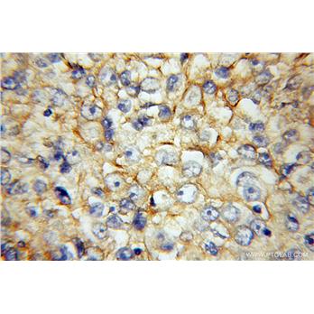 BSG Rabbit Polyclonal Antibody (11989-1-AP)
