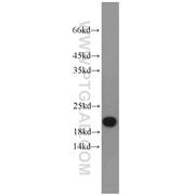 PRAP1 Rabbit Polyclonal Antibody (11932-1-AP)
