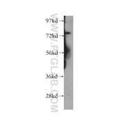 PHF21A Rabbit Polyclonal Antibody (12127-1-AP)