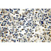 IKZF1 Rabbit Polyclonal Antibody (12016-1-AP)