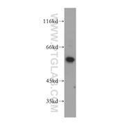DGKE Rabbit Polyclonal Antibody (11900-1-AP)