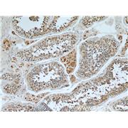 WBP2 Rabbit Polyclonal Antibody (12030-1-AP)