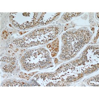 WBP2 Rabbit Polyclonal Antibody (12030-1-AP)