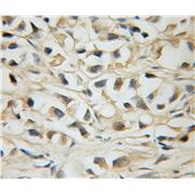 MLX Rabbit Polyclonal Antibody (12042-1-AP)