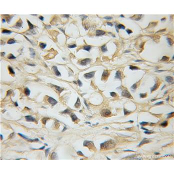 MLX Rabbit Polyclonal Antibody (12042-1-AP)