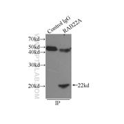 RAB22A Rabbit Polyclonal Antibody (12125-1-AP)
