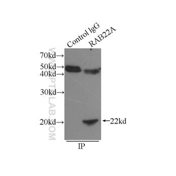 RAB22A Rabbit Polyclonal Antibody (12125-1-AP)