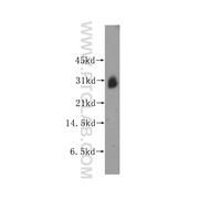 KCNIP3 Rabbit Polyclonal Antibody (12032-1-AP)