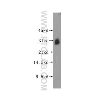 KCNIP3 Rabbit Polyclonal Antibody (12032-1-AP)