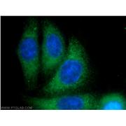 PBXIP1 Rabbit Polyclonal Antibody (12102-1-AP)