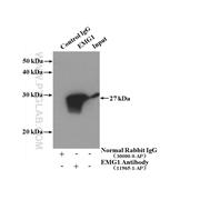 EMG1 Rabbit Polyclonal Antibody (11965-1-AP)