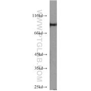 STAT5B Rabbit Polyclonal Antibody (12071-1-AP)