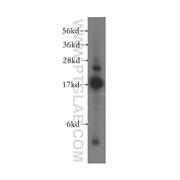 SUB1 Rabbit Polyclonal Antibody (11956-1-AP)
