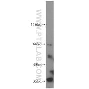 SRPR Rabbit Polyclonal Antibody (12090-1-AP)
