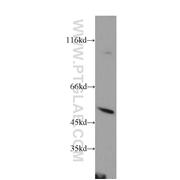 PSTPIP1 Rabbit Polyclonal Antibody (11951-1-AP)