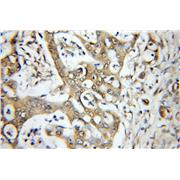 MAP3K11 Rabbit Polyclonal Antibody (11996-1-AP)