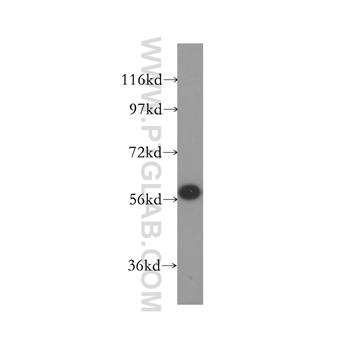 SF3A3 Rabbit Polyclonal Antibody (12070-1-AP)