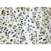 NPM3 Rabbit Polyclonal Antibody (11960-1-AP)