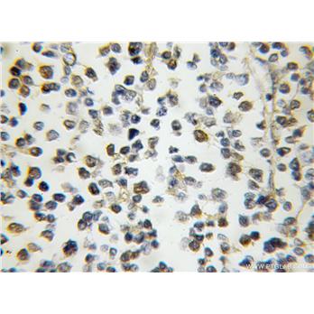 NPM3 Rabbit Polyclonal Antibody (11960-1-AP)