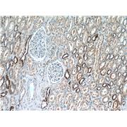 KIF12 Rabbit Polyclonal Antibody (12035-1-AP)