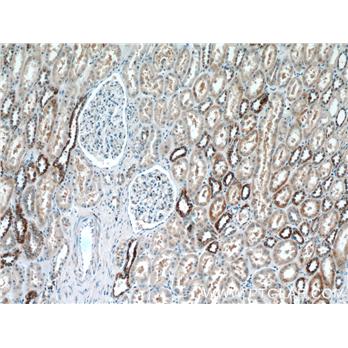 KIF12 Rabbit Polyclonal Antibody (12035-1-AP)