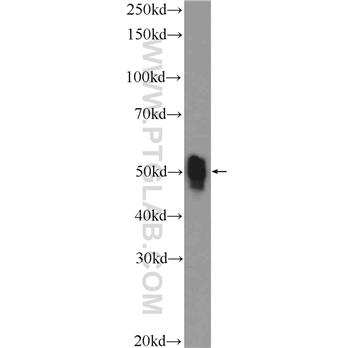 ETS1 Rabbit Polyclonal Antibody (12118-1-AP)