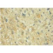 CHST10 Rabbit Polyclonal Antibody (12013-1-AP)