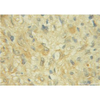 CHST10 Rabbit Polyclonal Antibody (12013-1-AP)