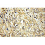 RARRES3 Rabbit Polyclonal Antibody (12065-1-AP)