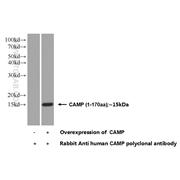 CAMP Rabbit Polyclonal Antibody (12009-1-AP)
