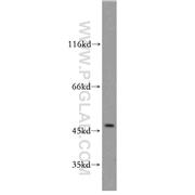 SGCB Rabbit Polyclonal Antibody (11936-1-AP)