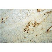 APOH Rabbit Polyclonal Antibody (11892-1-AP)
