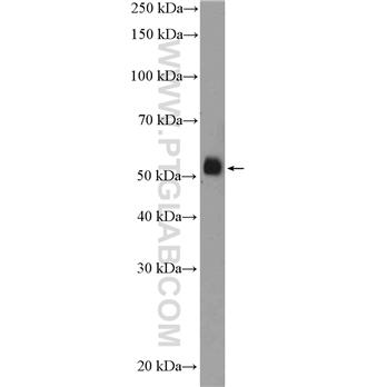 FICD Rabbit Polyclonal Antibody (11974-1-AP)