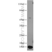 PCBD2 Rabbit Polyclonal Antibody (11958-1-AP)