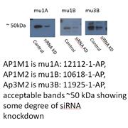 AP1M1 Rabbit Polyclonal Antibody (12112-1-AP)