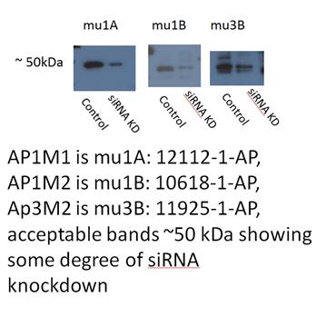 AP1M1 Rabbit Polyclonal Antibody (12112-1-AP)